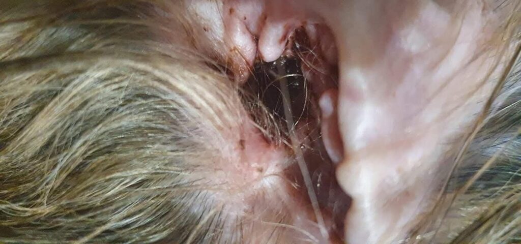 Nawracający stan zapalny uszu – uczulenie